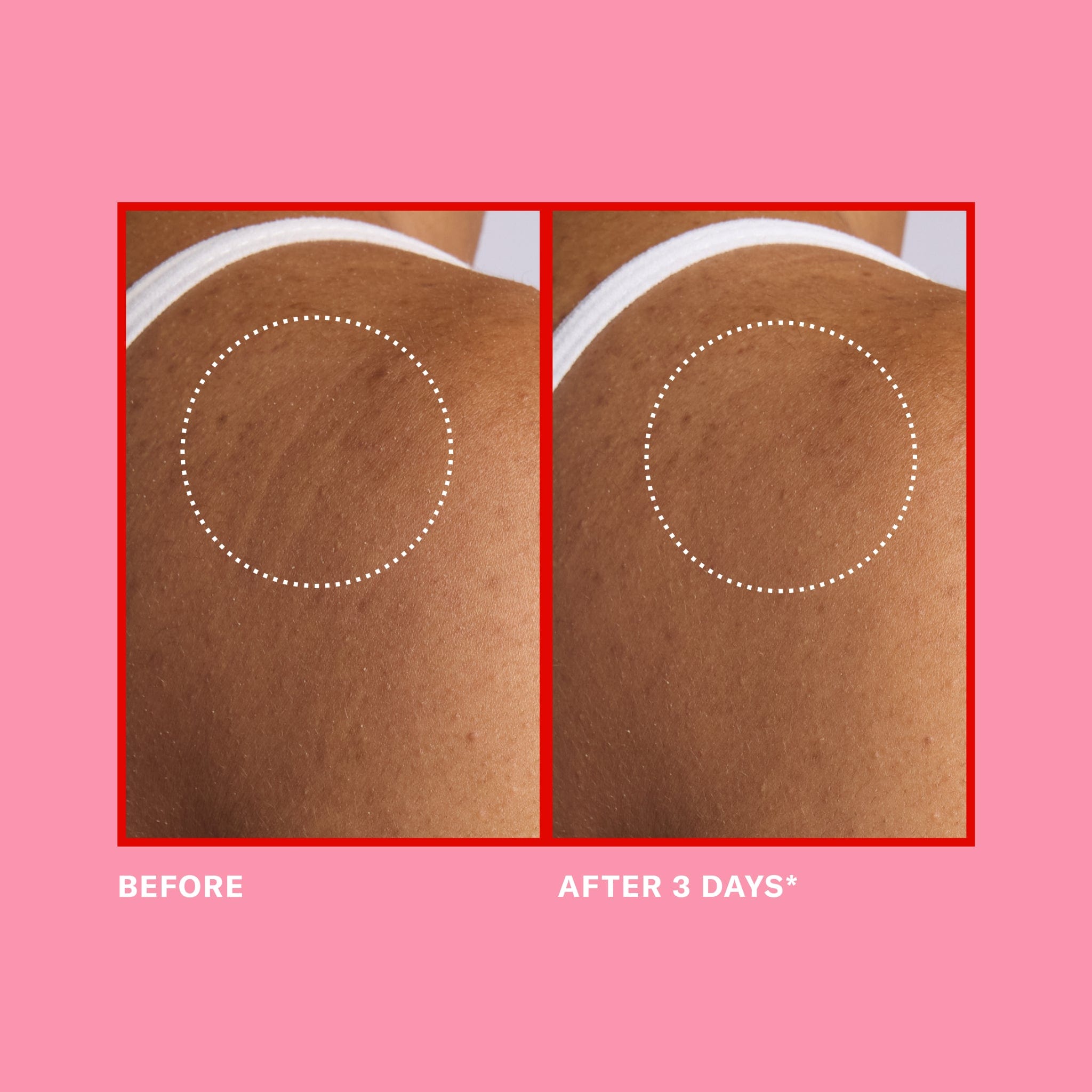 Pink Algae Pro-Retinol Body Butter - Image 4